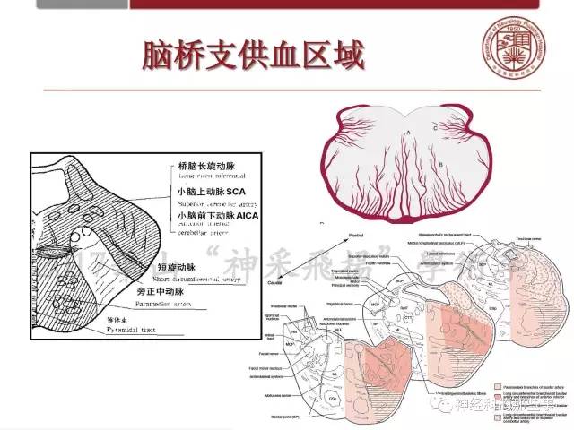 【PPT】脑血管病的影像诊断基础
