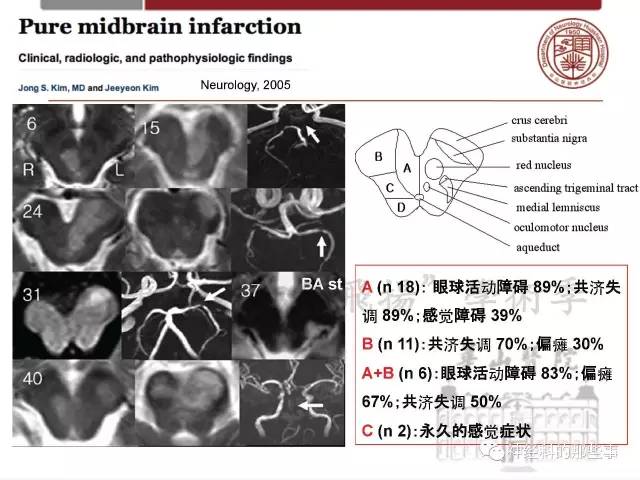 【PPT】脑血管病的影像诊断基础