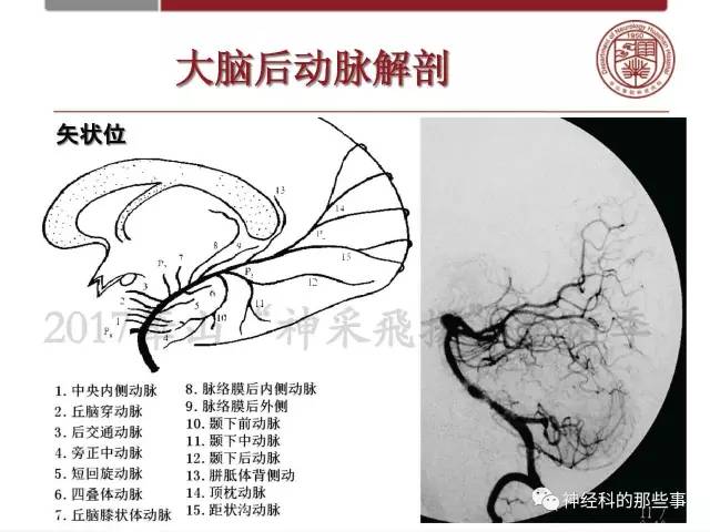 【PPT】脑血管病的影像诊断基础