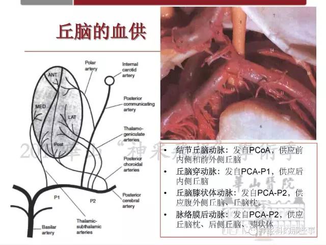【PPT】脑血管病的影像诊断基础