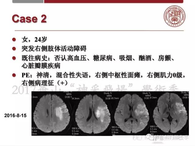 【PPT】脑血管病的影像诊断基础