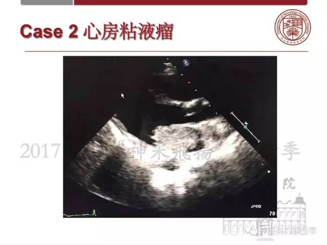 【PPT】脑血管病的影像诊断基础