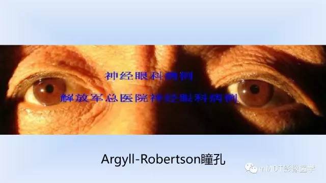 【PPT】神经梅毒的影像诊断