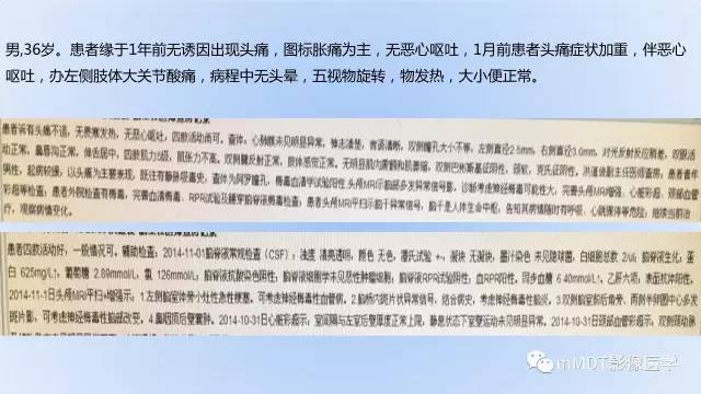 【PPT】神经梅毒的影像诊断