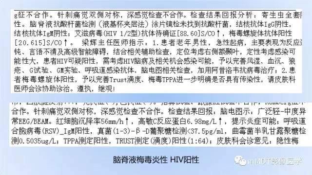 【PPT】神经梅毒的影像诊断