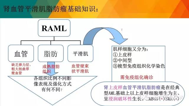 【PPT】肾血管平滑肌脂肪瘤影像表现