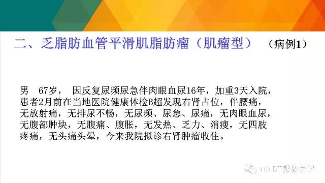 【PPT】肾血管平滑肌脂肪瘤影像表现