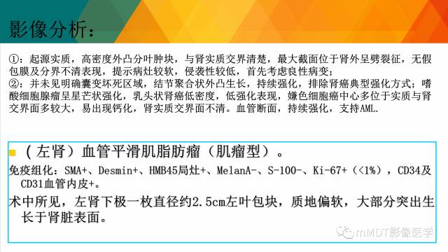 【PPT】肾血管平滑肌脂肪瘤影像表现