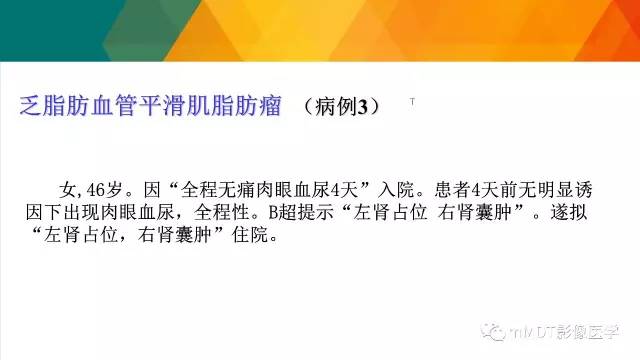 【PPT】肾血管平滑肌脂肪瘤影像表现