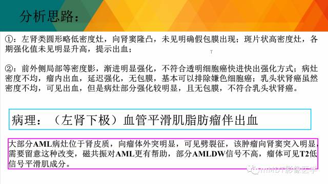 【PPT】肾血管平滑肌脂肪瘤影像表现