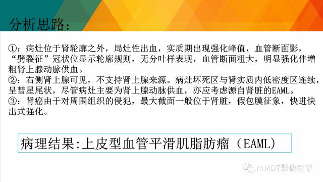 【PPT】肾血管平滑肌脂肪瘤影像表现