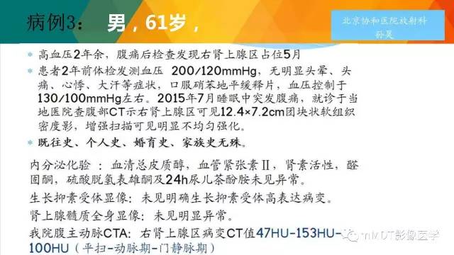 【PPT】肾血管平滑肌脂肪瘤影像表现