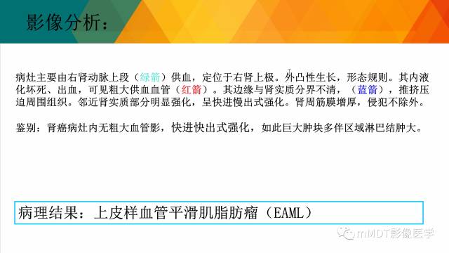 【PPT】肾血管平滑肌脂肪瘤影像表现