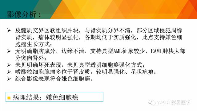 【PPT】肾血管平滑肌脂肪瘤影像表现