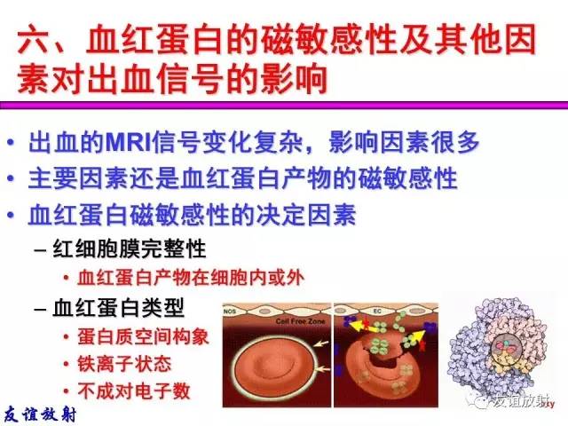 【PPT】基本病变的MR信号分析——出血MRI信号演变及分子机制