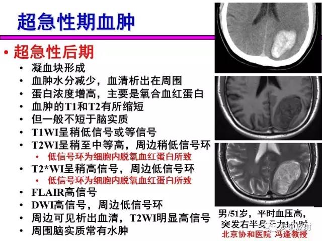 【PPT】基本病变的MR信号分析——出血MRI信号演变及分子机制