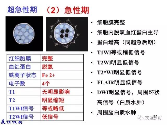 【PPT】基本病变的MR信号分析——出血MRI信号演变及分子机制