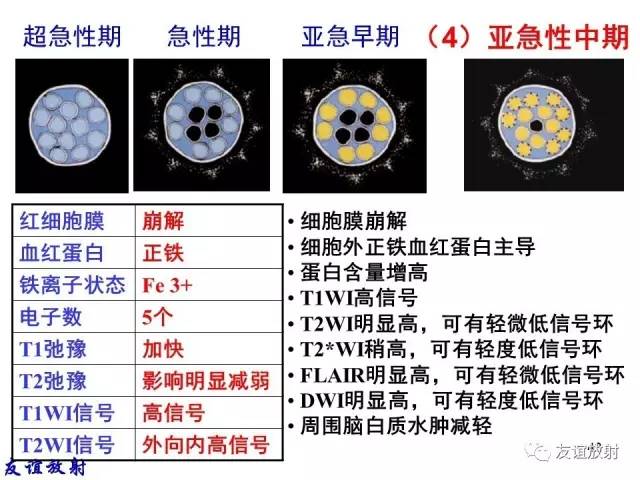 【PPT】基本病变的MR信号分析——出血MRI信号演变及分子机制
