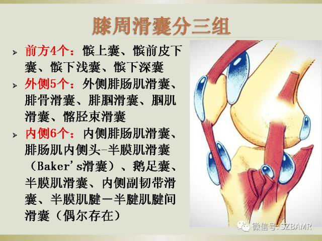 【PPT】膝关节滑囊影像解剖与病变