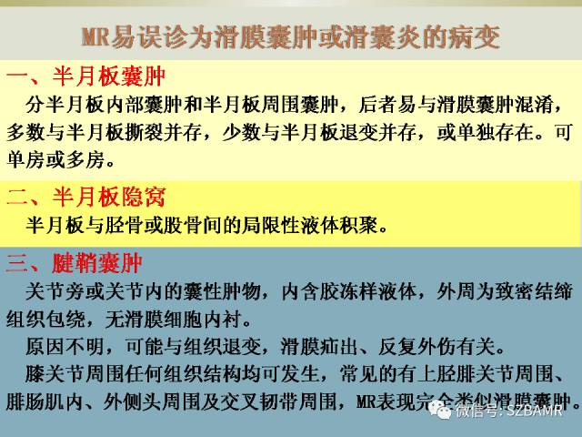 【PPT】膝关节滑囊影像解剖与病变