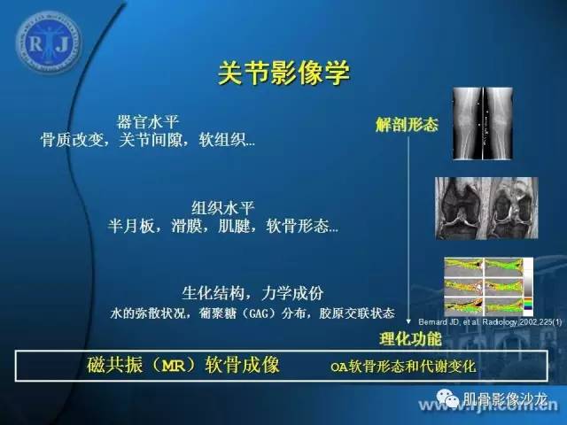 【PPT】磁共振软骨成像与骨关节炎治疗评价