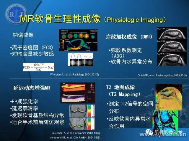 【PPT】磁共振软骨成像与骨关节炎治疗评价