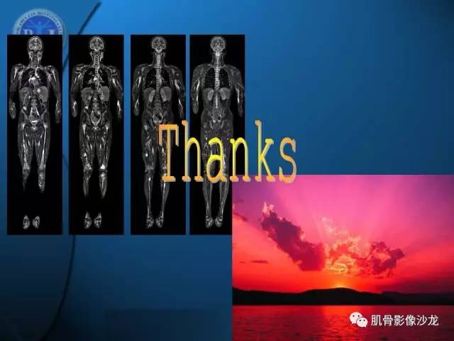 【PPT】磁共振软骨成像与骨关节炎治疗评价