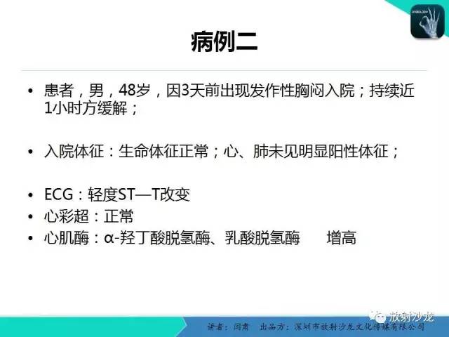 【PPT】冠脉CT与临床