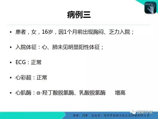 【PPT】冠脉CT与临床