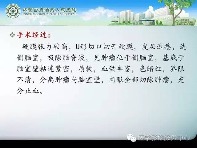 【病例】中枢神经细胞瘤1例MR影像表现