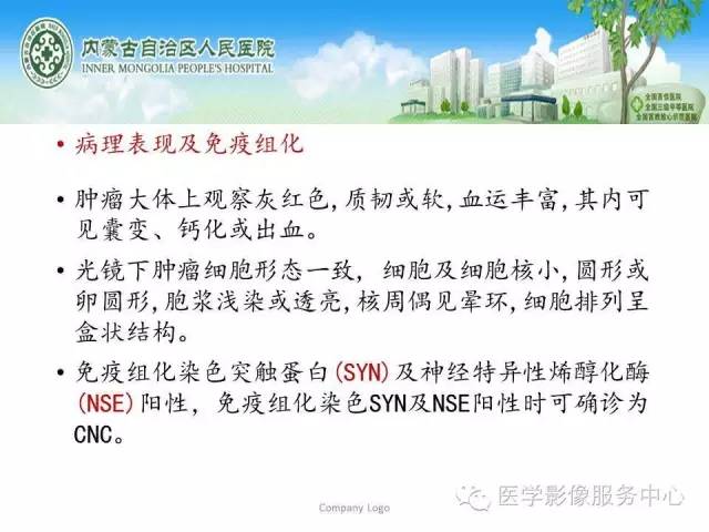 【病例】中枢神经细胞瘤1例MR影像表现