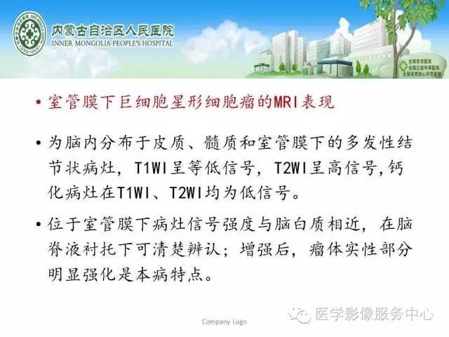 【病例】中枢神经细胞瘤1例MR影像表现