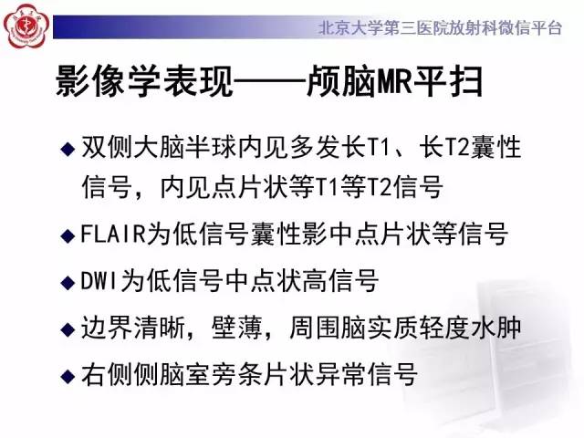 【病例】脑囊虫病1例MR影像表现