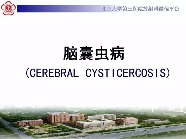 【病例】脑囊虫病1例MR影像表现
