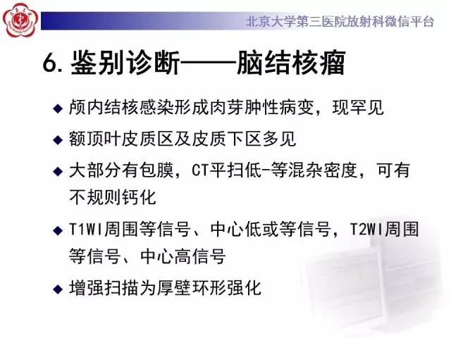 【病例】脑囊虫病1例MR影像表现