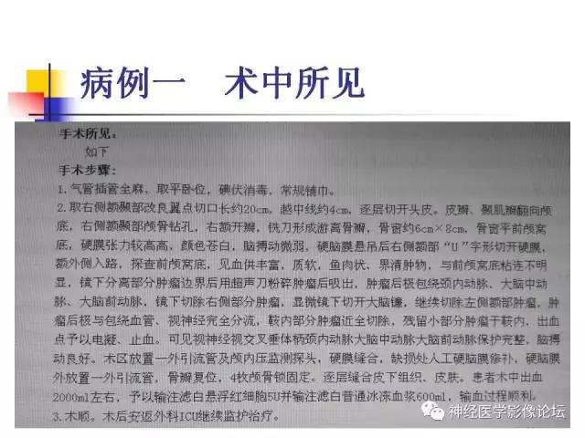 【病例】垂体腺瘤 VS 颅咽管瘤各一例MR