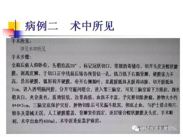 【病例】垂体腺瘤 VS 颅咽管瘤各一例MR