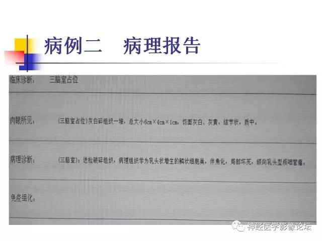 【病例】垂体腺瘤 VS 颅咽管瘤各一例MR