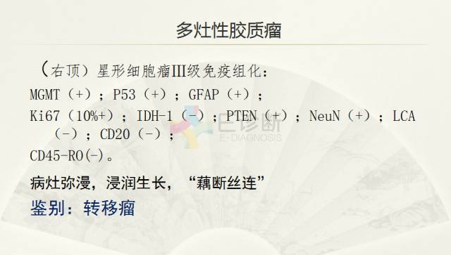 【PPT】脑转移瘤诊断与鉴别