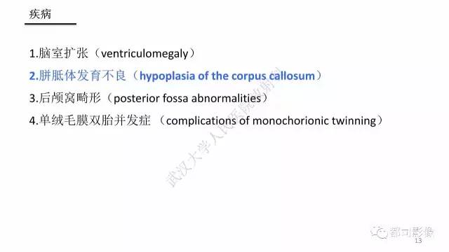 【PPT】MRI of the fetal brain