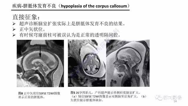 【PPT】MRI of the fetal brain