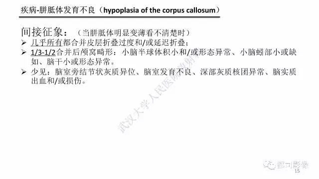 【PPT】MRI of the fetal brain