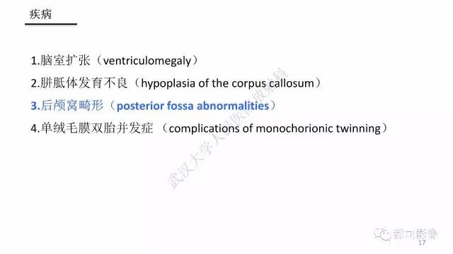 【PPT】MRI of the fetal brain