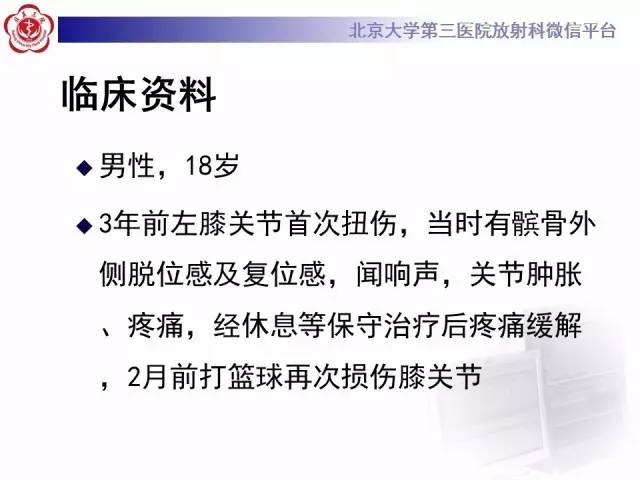 【病例】髌股关节不稳1例X线CT及MR影像表现