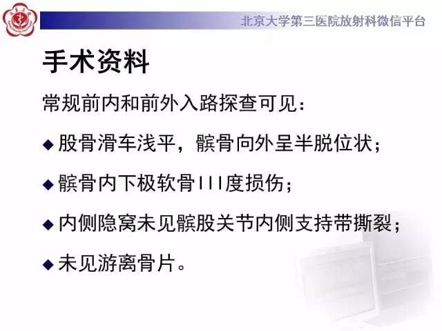 【病例】髌股关节不稳1例X线CT及MR影像表现