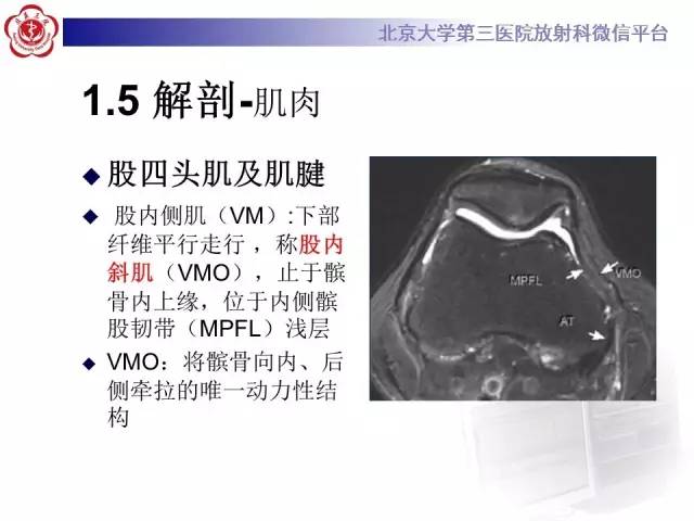 【病例】髌股关节不稳1例X线CT及MR影像表现