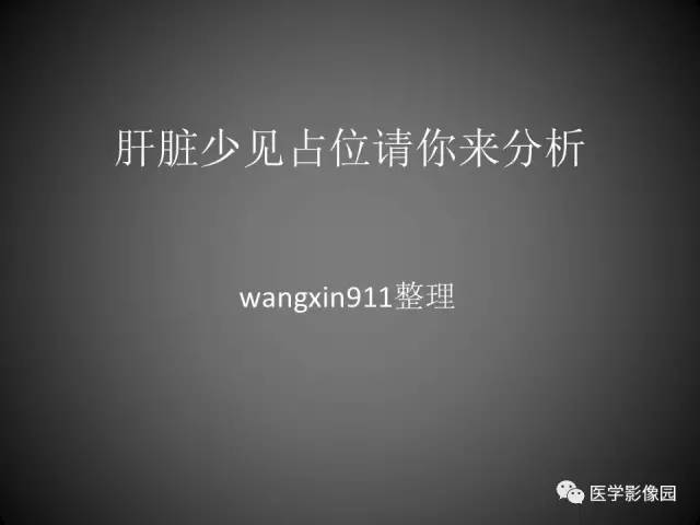 【病例】肝脏巨大血管平滑肌脂肪瘤1例CT