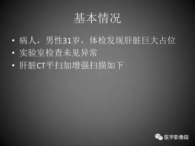 【病例】肝脏巨大血管平滑肌脂肪瘤1例CT