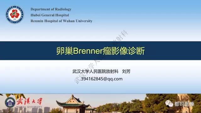 【PPT】卵巢Brenner瘤影像诊断