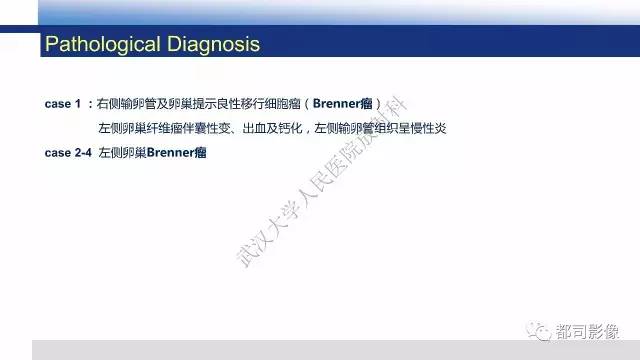 【PPT】卵巢Brenner瘤影像诊断